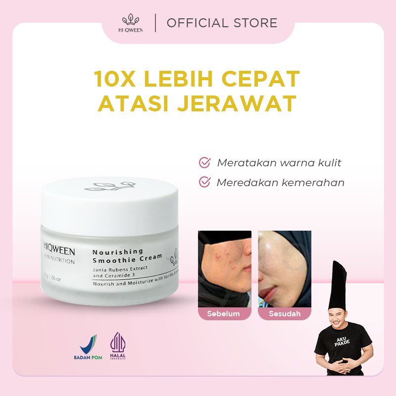 HIQWEEN MOISTURISER NOURISHING SMOOTHIE CREAM PELEMBAB MOISTURIZER KULIT BER JERAWAT BERUNTUSAN ACNE