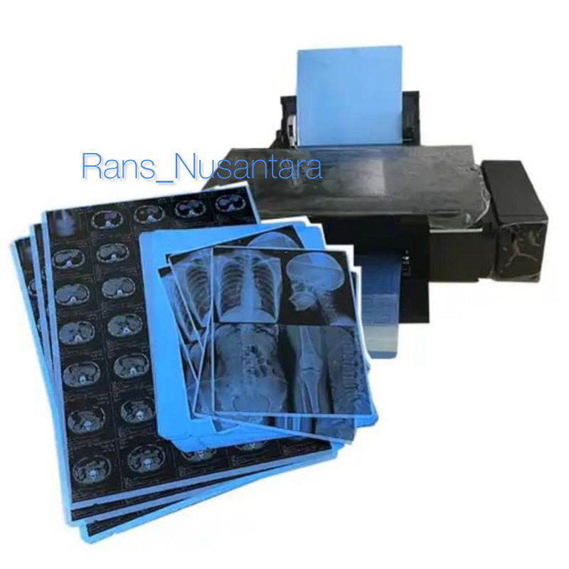 Film XRay Radiologi / Film X-Ray Blue / Film Radiology / Foto Rontgen / Medical Dry Inkjet Film / Fi