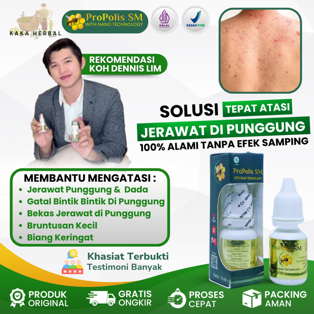Obat Jerawat Punggung & Dada, Gatal, Bruntusan, Biang Keringat - Propolis SM Penghilang Jerawat dan 