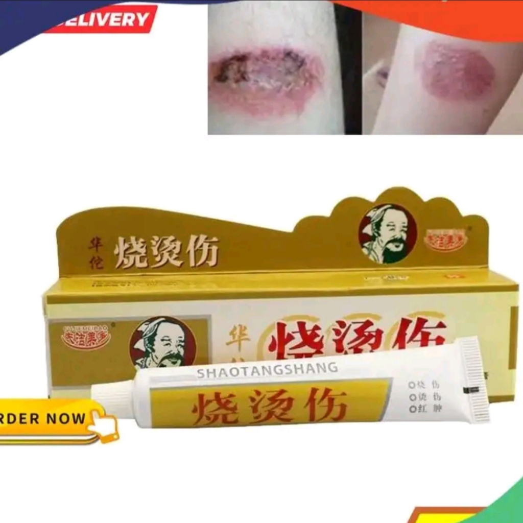 ORI Salep Herbal Obat Luka Bakar & Kena Air Minyak Panas Kulit Melepuh