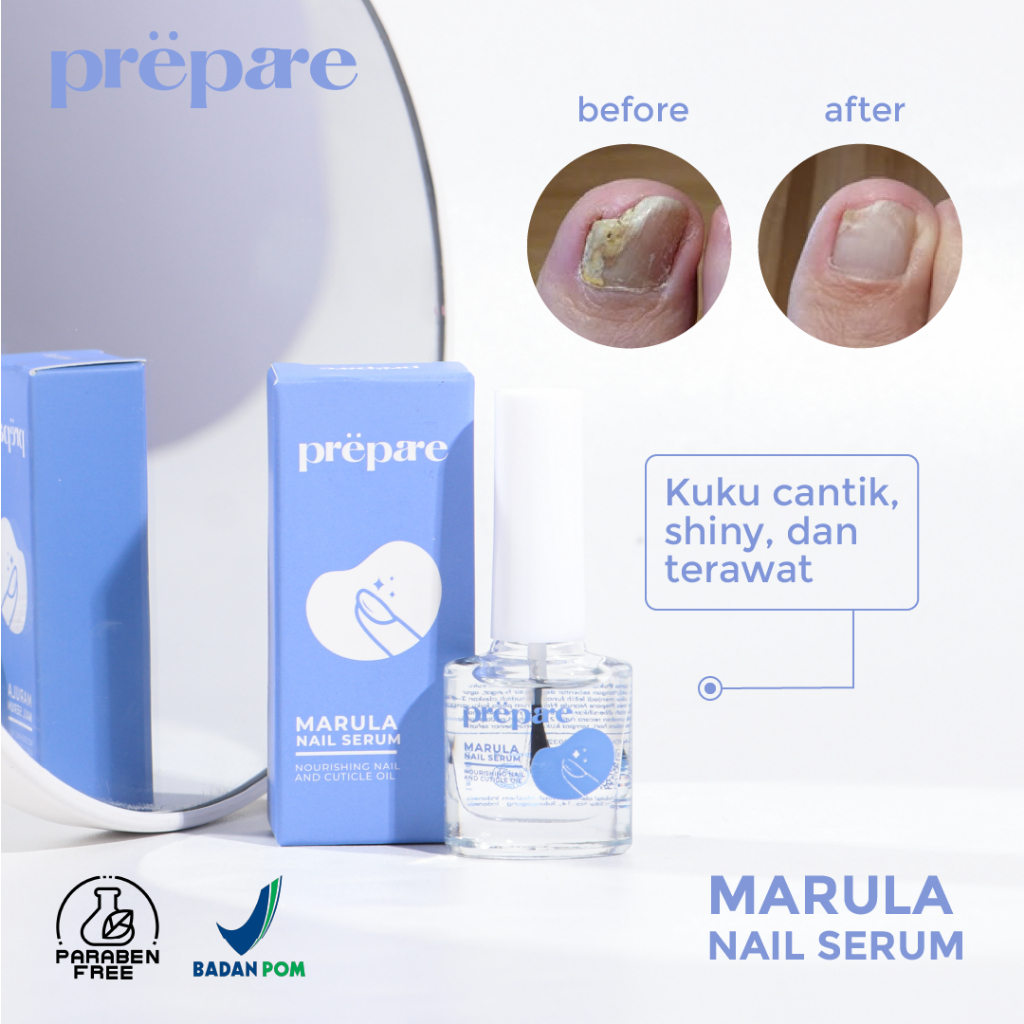 Prepare Nail Serum Kuku Cantengan Obat Jamur Kuku Penghalus Kuku Rusak Perawatan Kuku Kaki Tangan