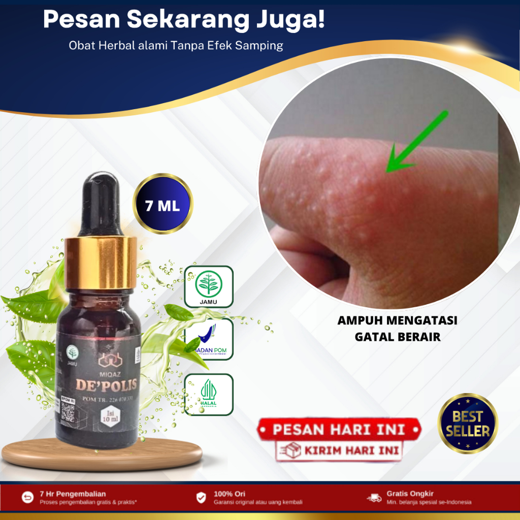 Obat Gatal Bintik Berair, Gatal Berair, Salep Gatal Bintik Berair, Penghilang Bintik Berair Di Telap