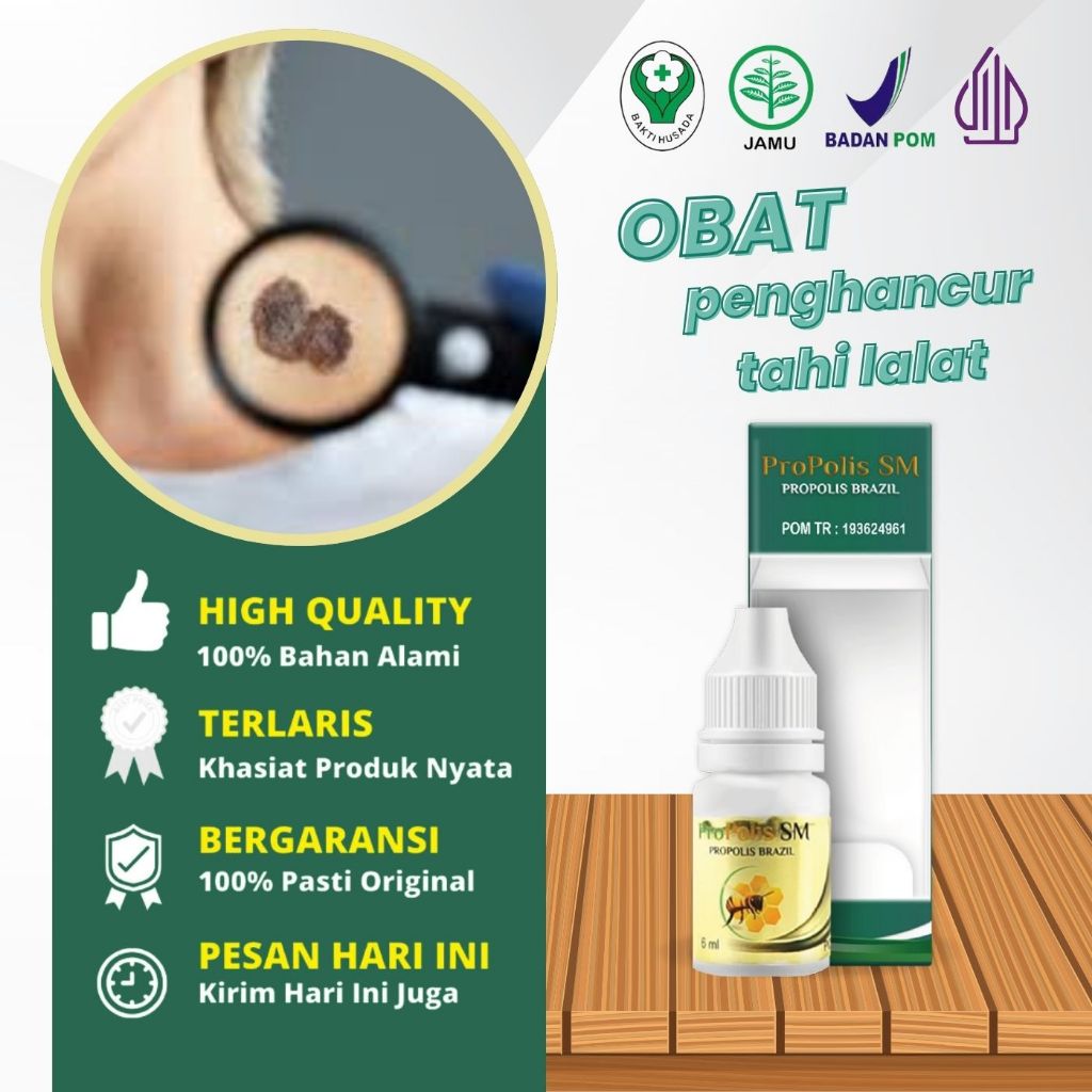 Propolis SM Herbal - Obat Penghancur tahi lalat, Obat penghilang tahi lalat di wajah, Obat tahi lala