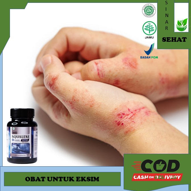 obat eksim Obat Eksim Menahun, Eksim Kering Bio Squalene - Obat Eksim Basah, Obat Eksim Menahun, Oba