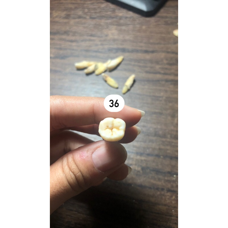 [NEW] GIGI ASLI MOLAR RB PRAKTIKUM