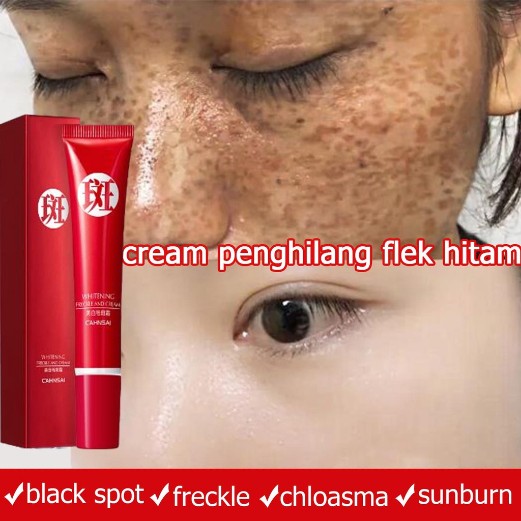 ✨Garansi Asli✨Penghilang flek hitam Cream penghilang flek hitam di wajah Salep flek hitam Melasma Ca