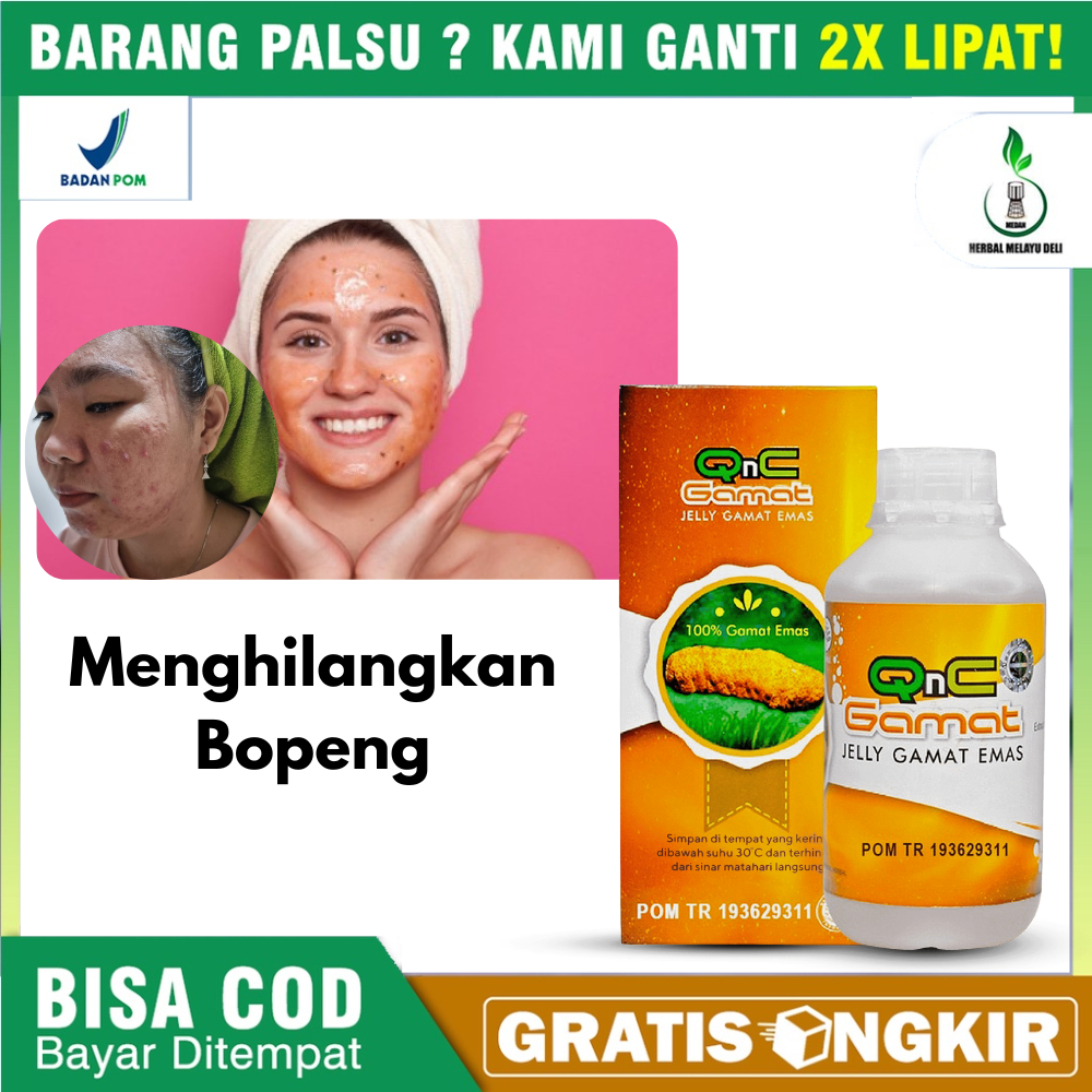 Obat Oles Bekas Jerawat , Bopeng Terparah , Jerawat Batu , Penghilang Bopeng Alami , Bopeng , Jerawa