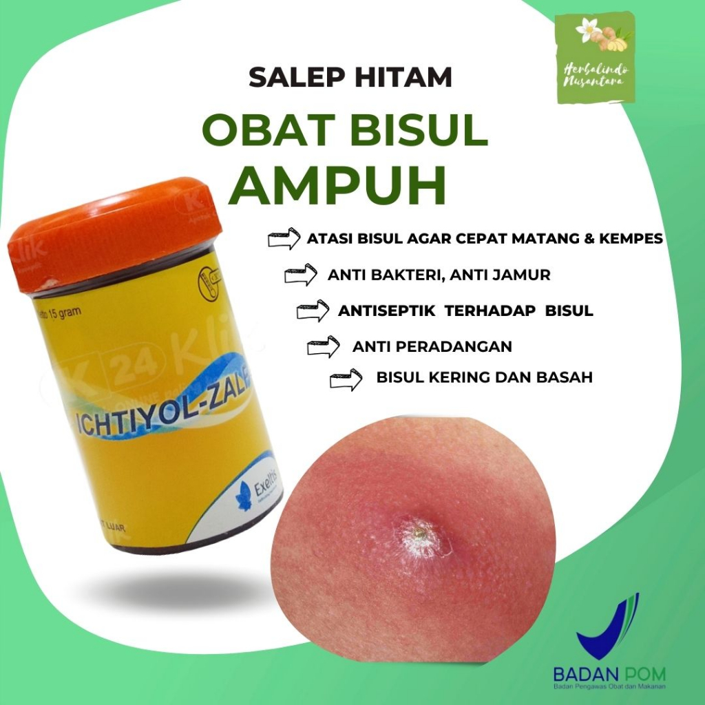 Salep Bisul Paling ampuh Obat bisul untuk dipantat salep bisul hitam ichtiyol zalf bisa untuk anak