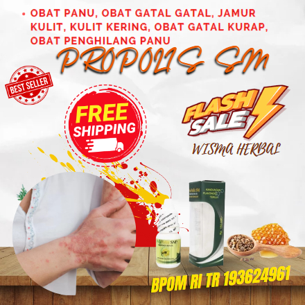 Obat Panu, Obat Gatal gatal, Jamur Kulit, Kulit Kering, Obat Gatal Kurap, Obat Penghilang Panu, Obat