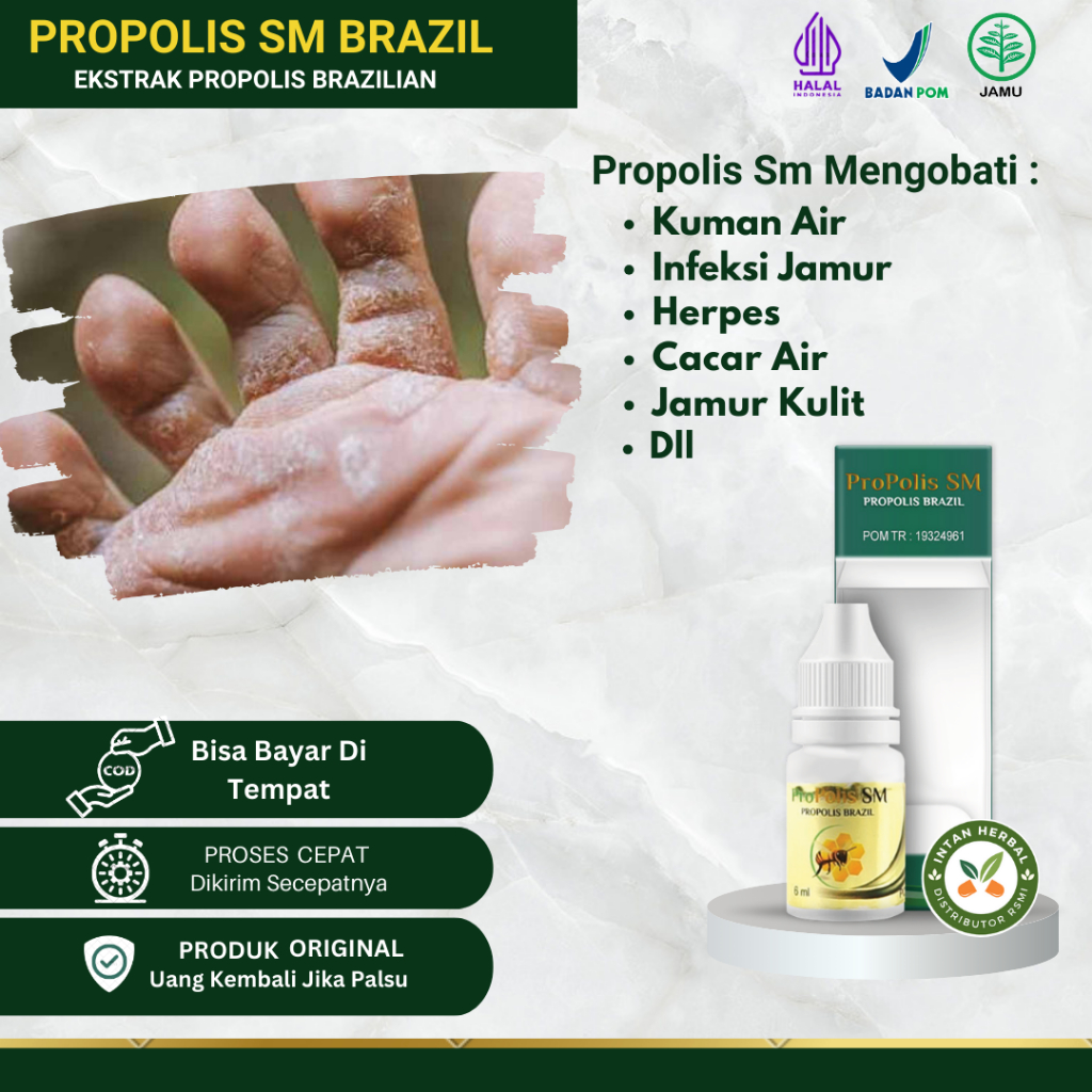 Propolis SM Obat Kutu Air Pada Kaki, Sela Jari Kaki, Kutu Air Telapak Kaki, Kutu Air Gatal Parah, Pe