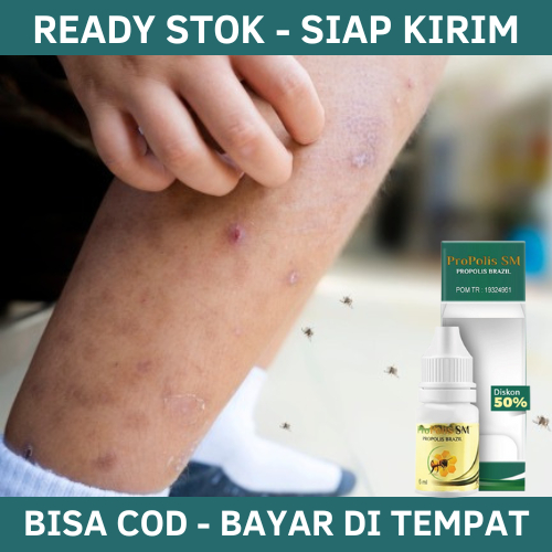 Obat Darah Manis, Obat Penyakit Prurigo (Darah Manis), Penghilang Darah Manis, Kulit Korengan, Bekas