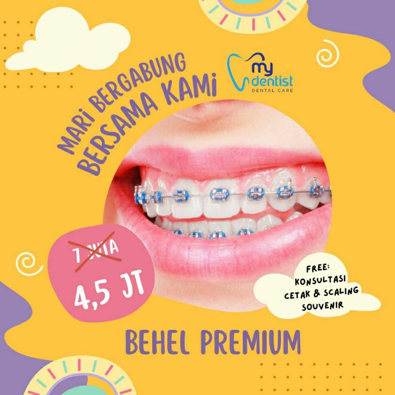 Voucher Perawatan Behel Gigi Premium USA / kawat gigi / Orthodonti Metal