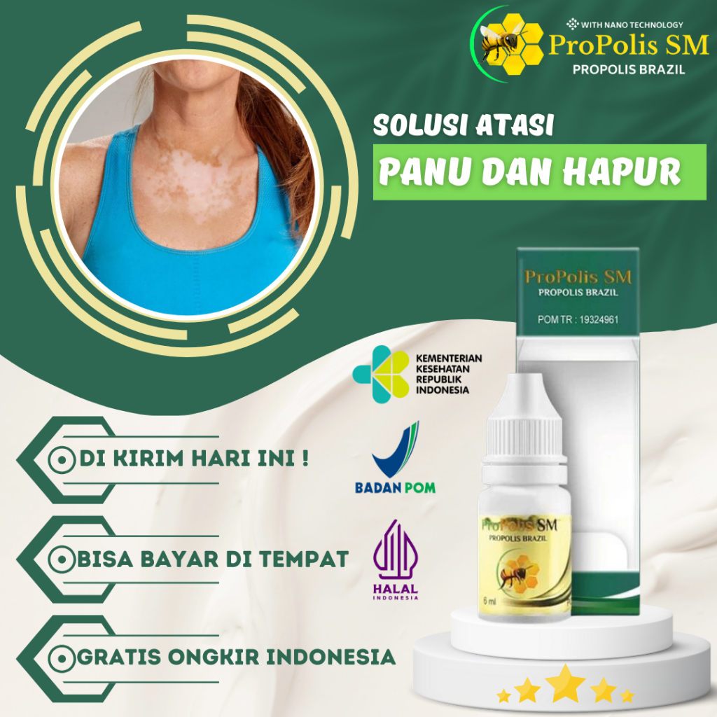 Obat Panu, Obat Hapuran, Penghilang Panu, Obat Hapur Kulit, Obat Scabies Kulit, Obat Budug, Obat Bor