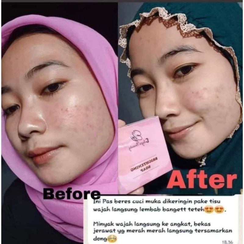 SABUN ELIZA BEAUTY /ELIZA BEAUTY BRIGHTENING SOAP