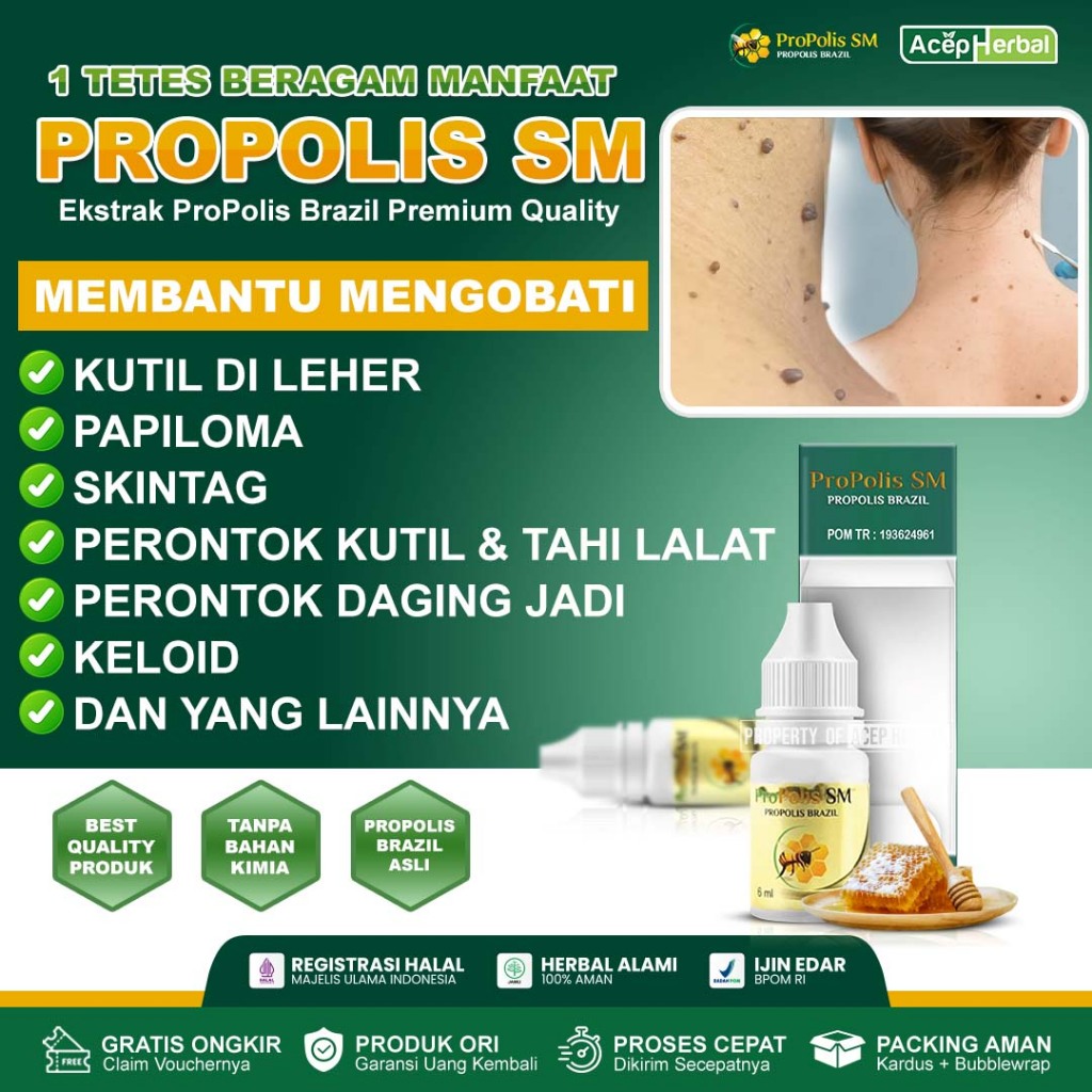 Obat Perontok Kutil Di Leher Papiloma Skin Tag Penghilang Tahi Lalat Bruntusan Bintik Bintik Hitam J