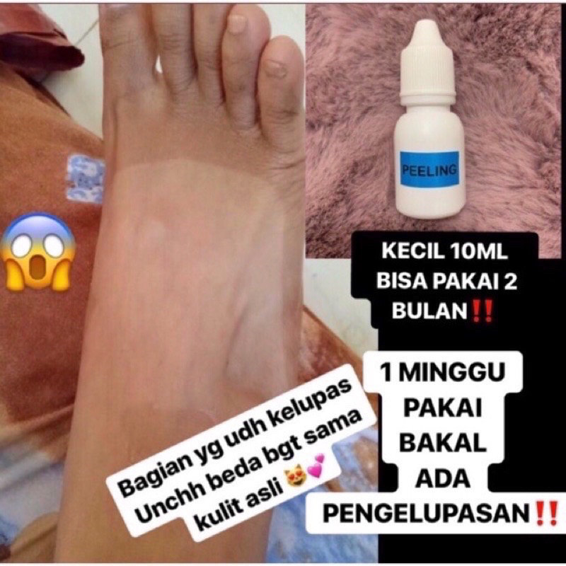 PEELING PENGELUPASAN KULIT MATI/BODY PEELING