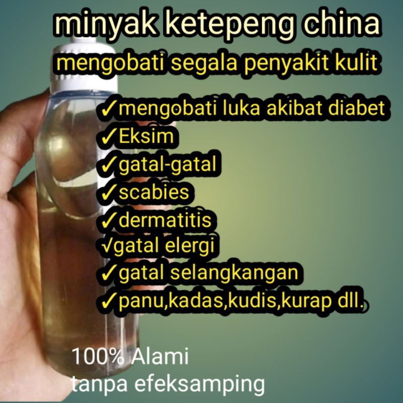 minyak ketepeng china/obat gatal/eksim/kudis/kurap