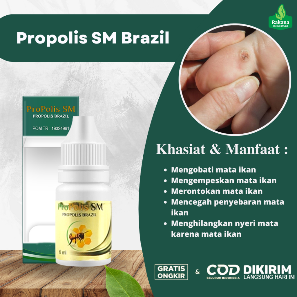 Obat Mata Ikan Di Telapak Kaki, Obat Penghilang Mata Ikan, Obat Tetes Mata Ikan, Obat Perontok Mata 