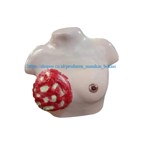 MANIKIN KANKER-TUMOR PAYUDARA/PHANTOM TORSO MANEKIN TUMOR PAYUDARA/ALAT PERAGA KANKER PAYUDARA