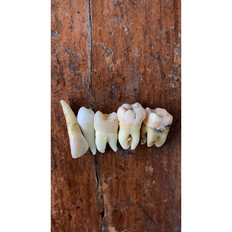 GIGI PRAKTIKUM SET KONSERVASI