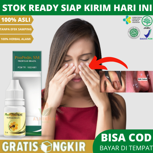 Obat Pengempis Konka Hidung Bengkak, Obat Benjolan Di Rongga Hidung, Obat Konka Polipoid Hipertrofi 