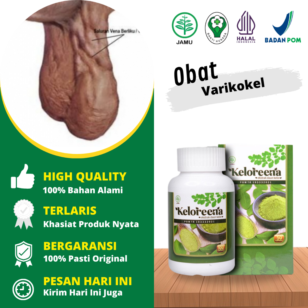 Obat Varikokel Paling Laris, Obat Varikokel, Obat Penghilang Varikokel, Obat Penyakit Varikokel, Oba