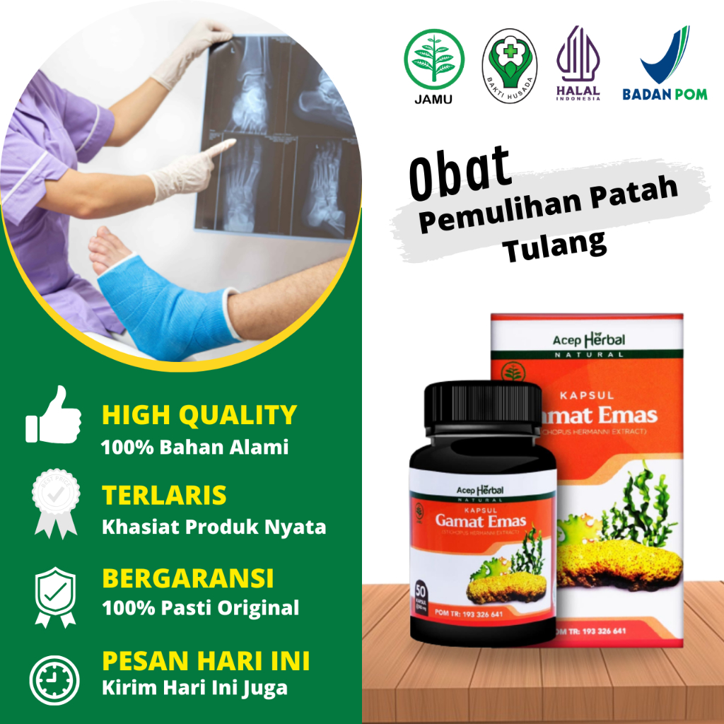 Obat Mepercepat Penyembuhan Patah Tulang, Obat Patah Tulang Kaki, Obat Patah Tulang Dan Bengkak, Oba