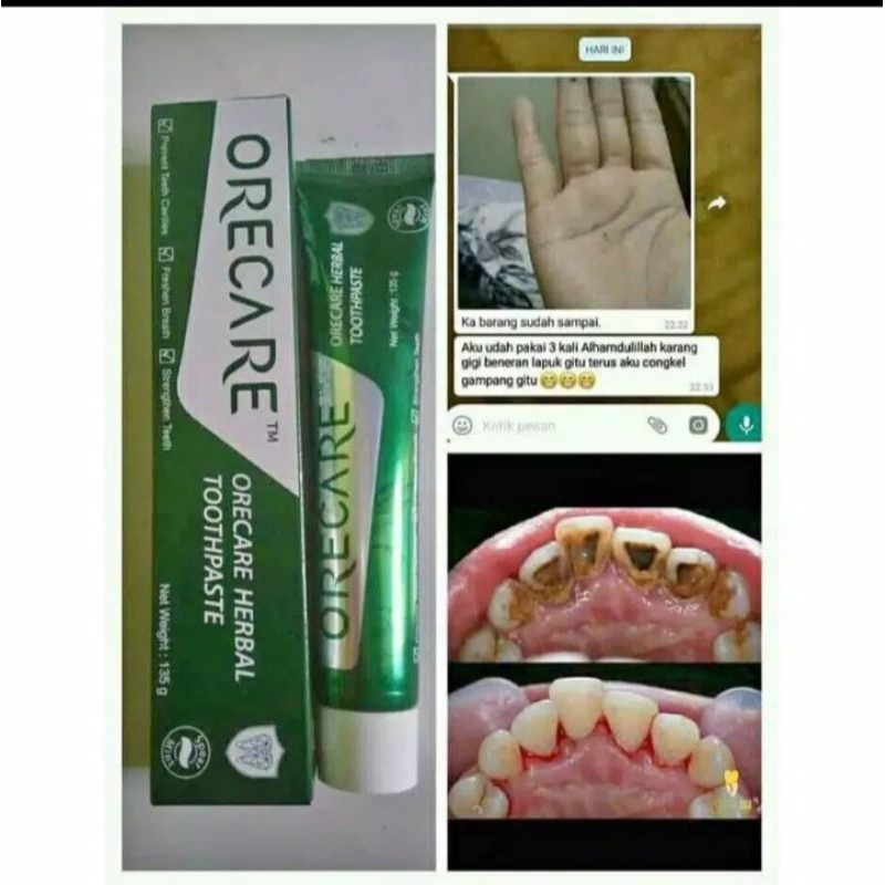 Orecare