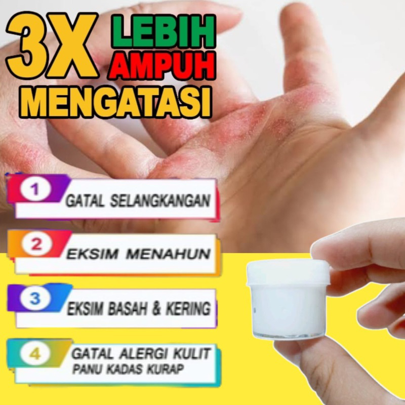 Salep racikan serbaguna untuk gatal alergi scabies dan psoriasis paling ampuh