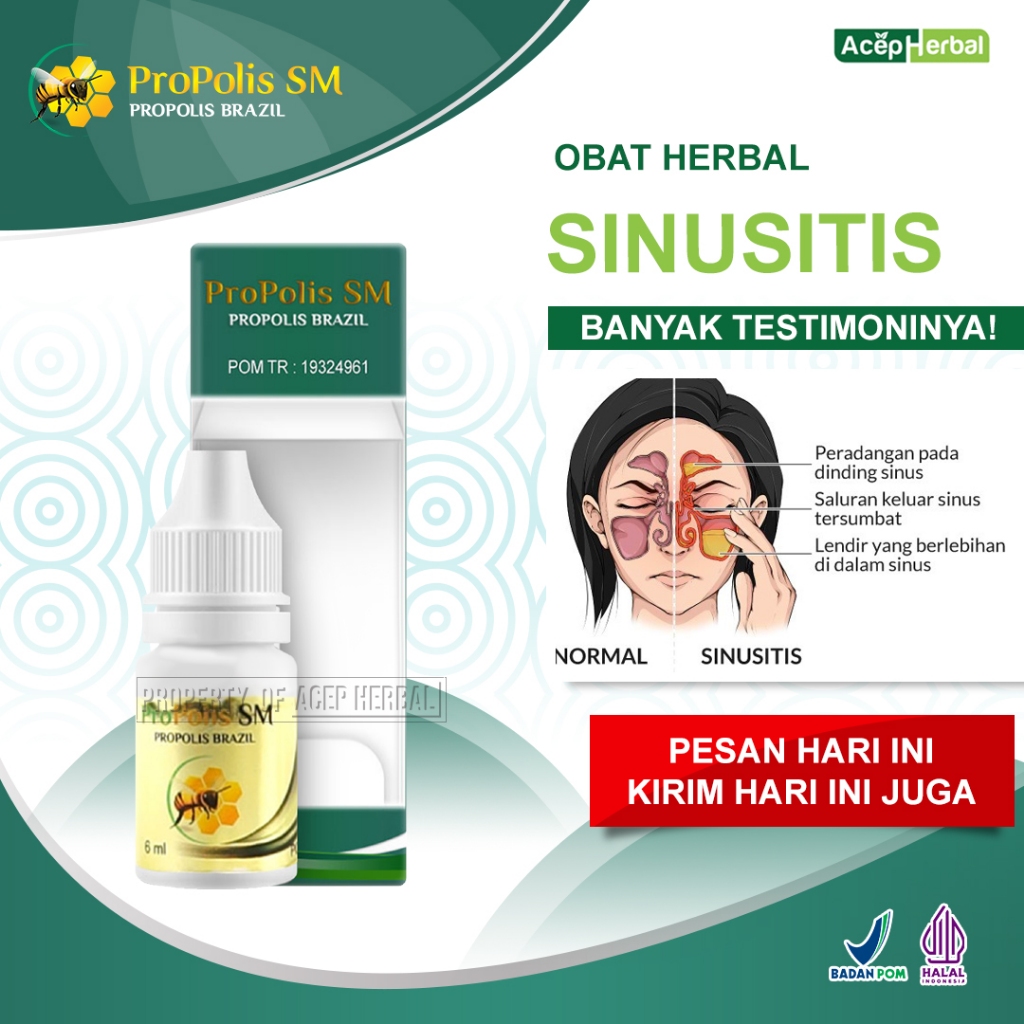 Obat Sinusitis Polip Hidung Hidung Tersumbat Benjolan Di Hidung Anosmia Flu Pilek Filek Menahun Hidu