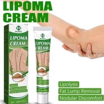 Ouhoe lipoma cream benjolan lipoma