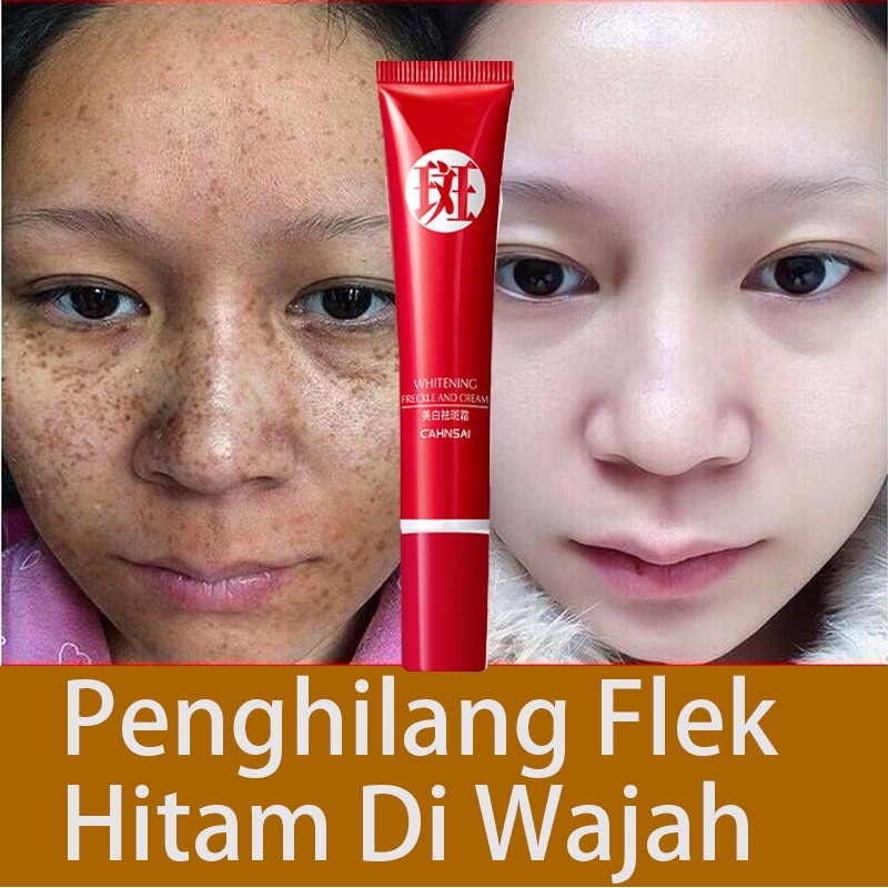 krim penghilang flek Krim pemutih Krim Bintik Pemutih Krim Pemutih Wajah Krim Penghilang Melasma ser