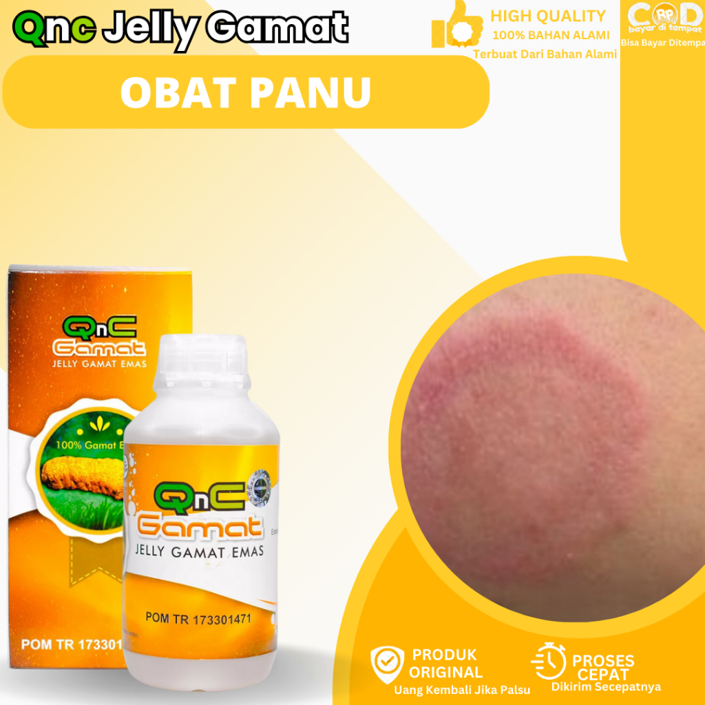 Obat Panu Menahun, Obat Gatal Jamur Kulit, Obat Menghilangkan Panu, Obat Kurap, Obat Bercak Putih Di