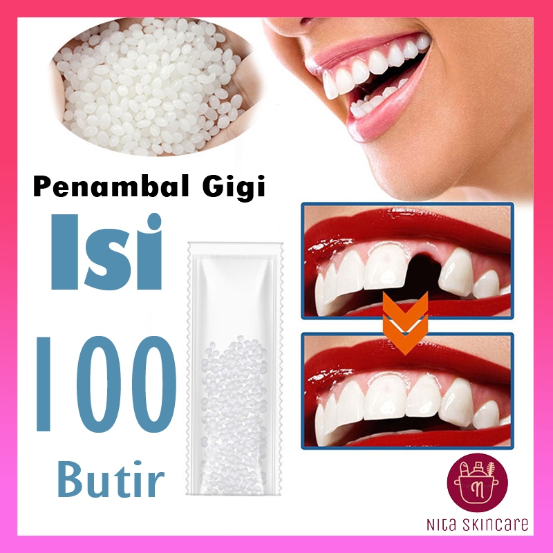[COD] 100 Butir Penambal Gigi Berlubang Gigi Depan Ompong ORIGINAL Gigi Palsu Original Penutup Gigi