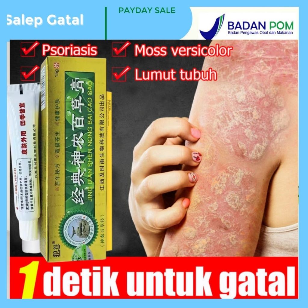 Salep Gatal Selengkangan Paling Ampuh Untuk Penyakit Kulit