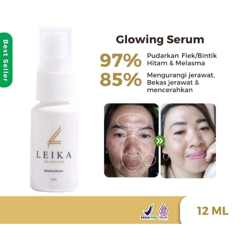 Leika Skincare Glowing Serum BPOM&halal MUI Serum Flek Hitam di Wajah dan Bintik Hitam Serum Anti Ag