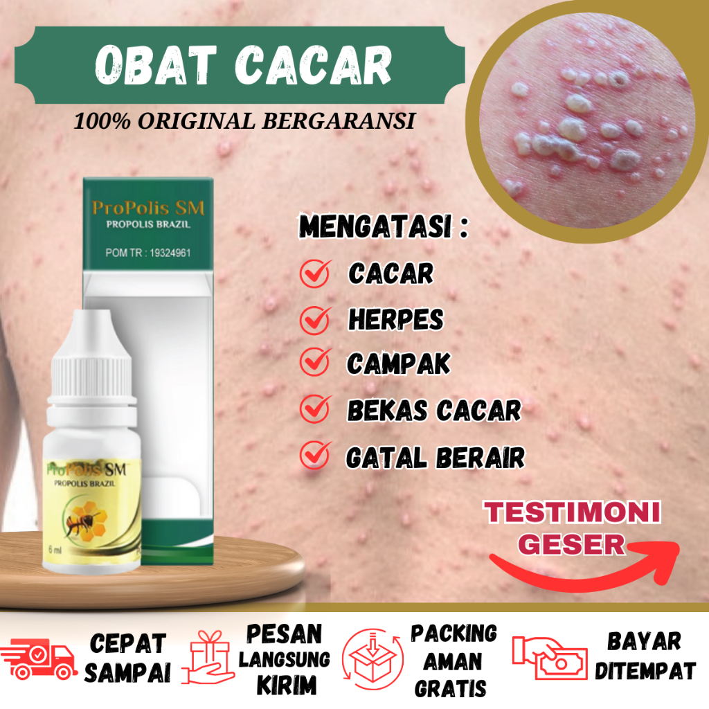 Obat Cacar, Obat Gatal Alergi Berair Bernanah Bentol Bintil, Penghilang Bintik Bintik Merah Berair C