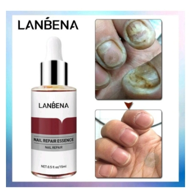 Lanbena nail repair essence/serum kuku/kuku berjamur