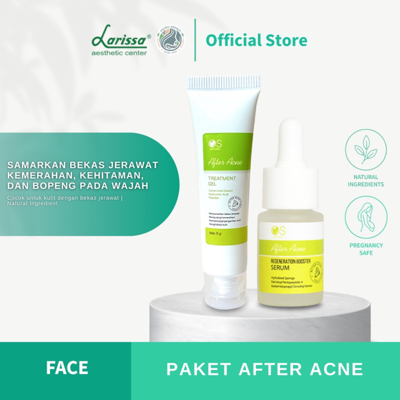 Larissa Paket Bekas Jerawat - After Acne Serum + After Acne Treatment Gel