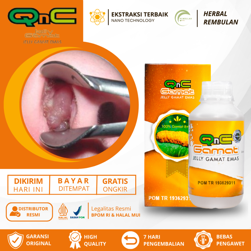 Obat Polip Hidung, Obat Benjolan Dalam Hidung, Obat Sinusitis Menahun, Obat Hidung Bau Busuk, Obat H