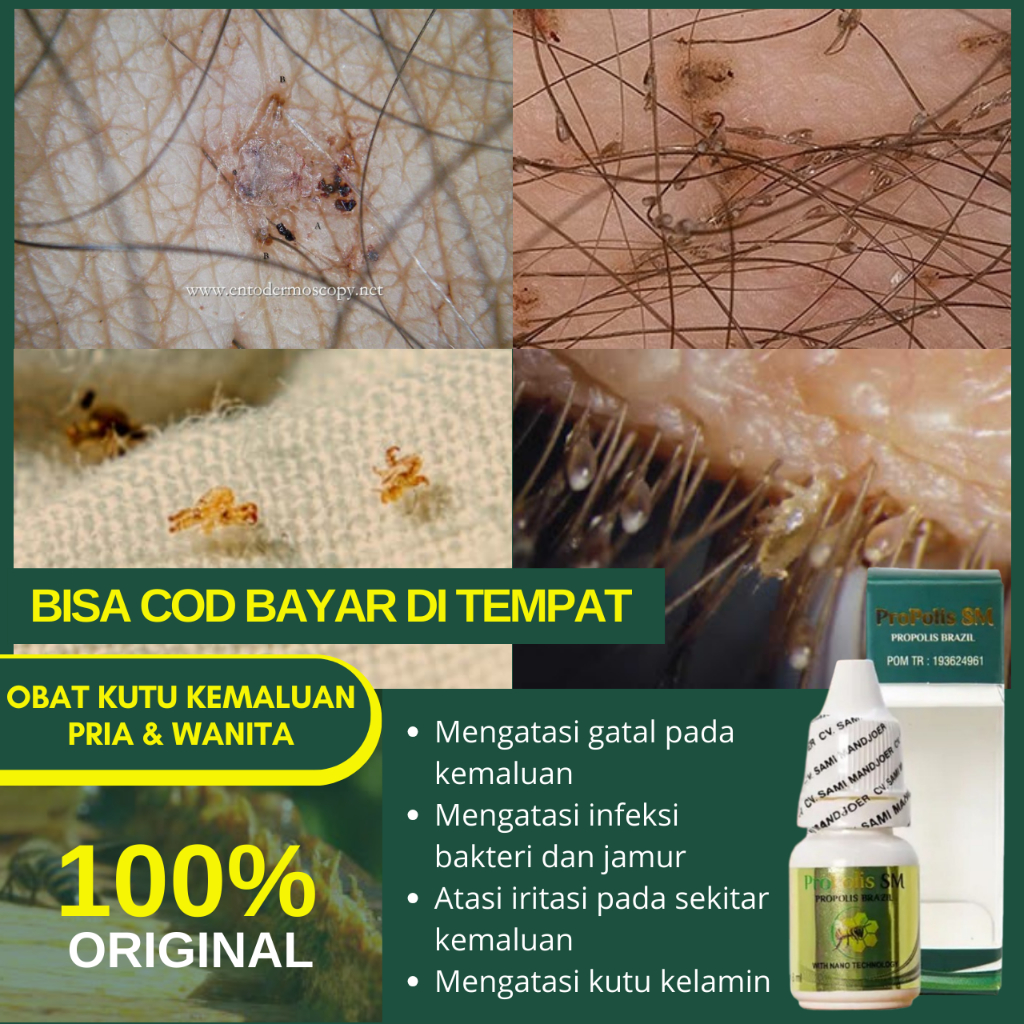 Obat Kutu Pubis Penghilang Kutu Rambut Kelamin Gatal Pada Kulit Kemaluan Pria Dan Wanita