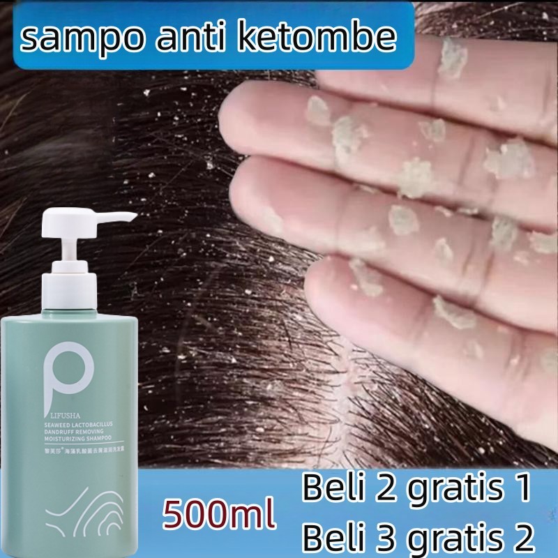 shampo anti ketombe anti gatal Shampo Penghilang Kutu tungau seboroik kulit kepala gatal perawatan k