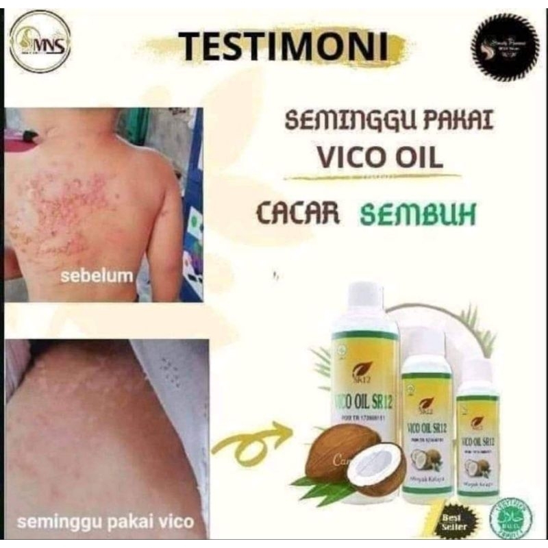 

Vco Virgin Coconut Oil/Minyak Kelapa Murni/Vico Oil SR12