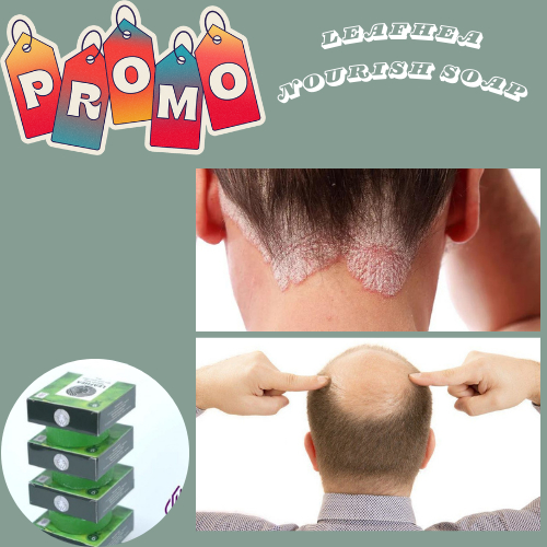 Obat Kepala Gatal Kerak, Kepala Berkerak, Ketombe Jamur, Obat Psoriasis, Kepala Bersisik,Dermatitis 