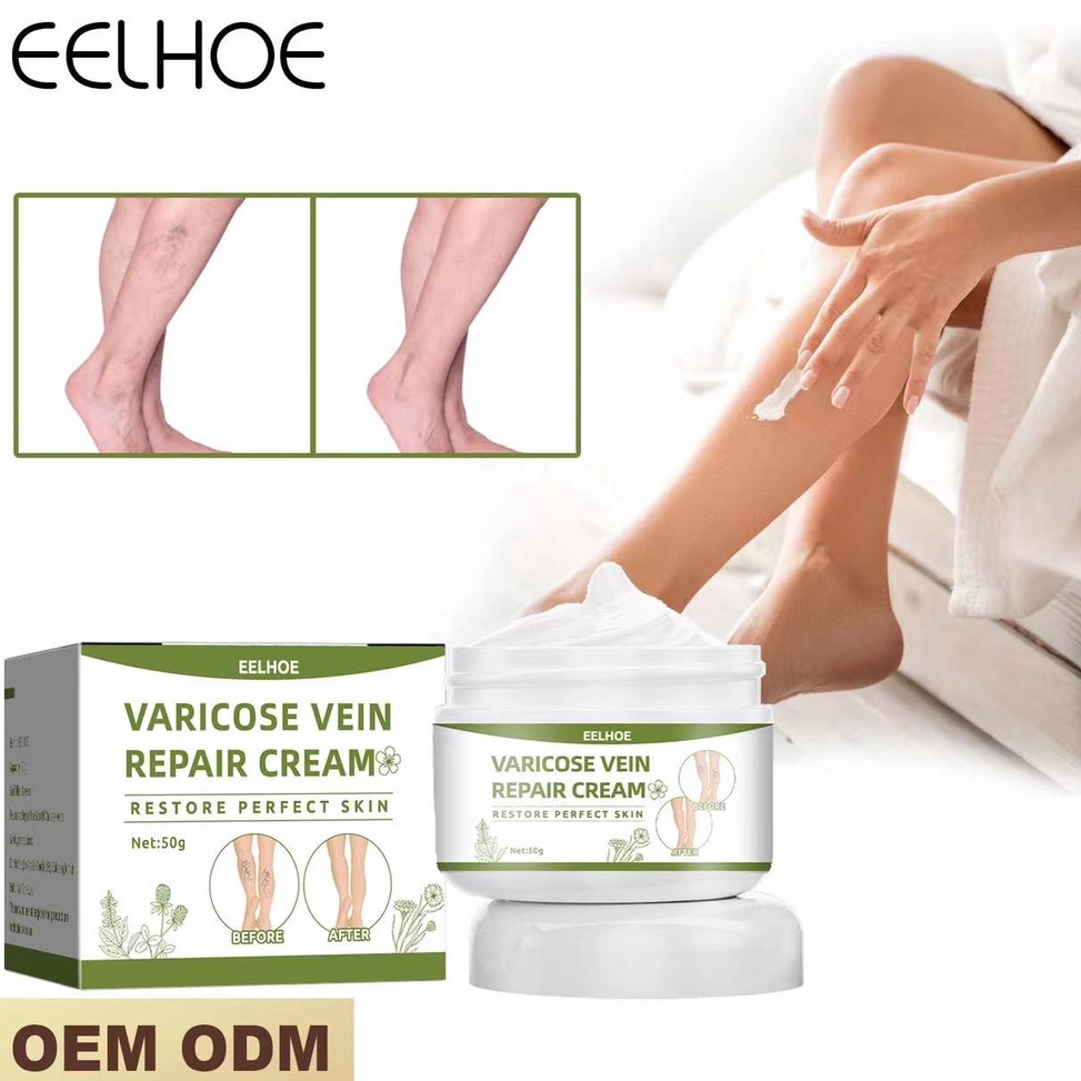 ART N62Y Eelhoe Krim Permanen Varises Krim Varises Vena Salep Flebitis Krim Kaki Varises Vena Pereda