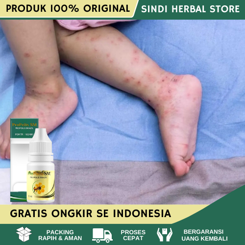Obat Darah Manis, Obat Darah Manis dan Bekas Luka, Obat Darah Manis Untuk Anak dan Dewasa, obat Peny