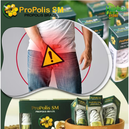 Obat Penis luka melepuh, Penghilang Luka Bakar Pada Penis, Obat Penis Lecet, Penis bengkak, Obat Kul