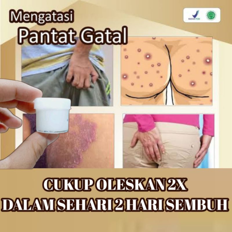 SALEP KHUSUS UNTUK GATAL PANTAT