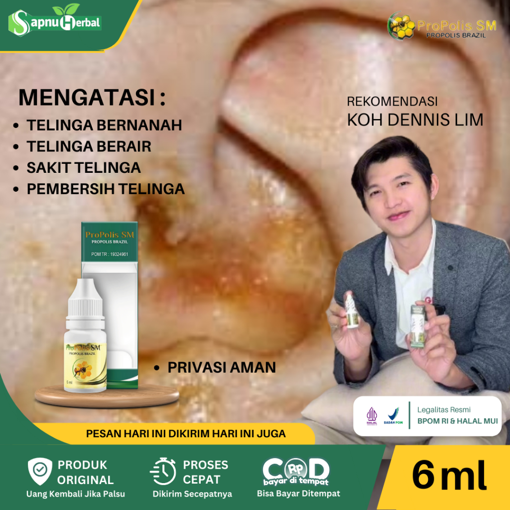 Obat Telinga Berair, Obat Penghilang Kotoran Telinga, Menghilangkan Kotoran Telinga Bau, Atasi