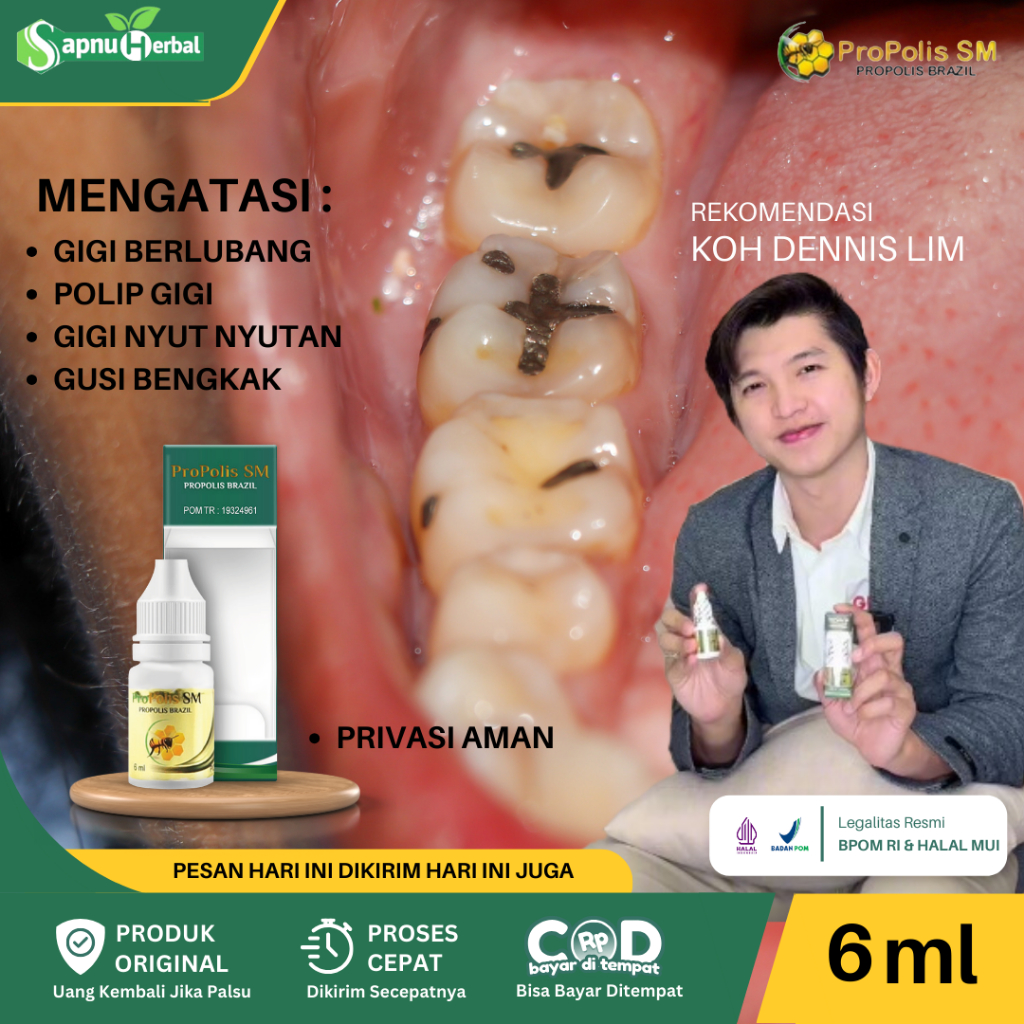 Sapnu Herbal - Obat Polip Pulpa Gigi, Obat Penghilang Polip Gigi, Obat Sakit Polip Gigi, Obat Polip 